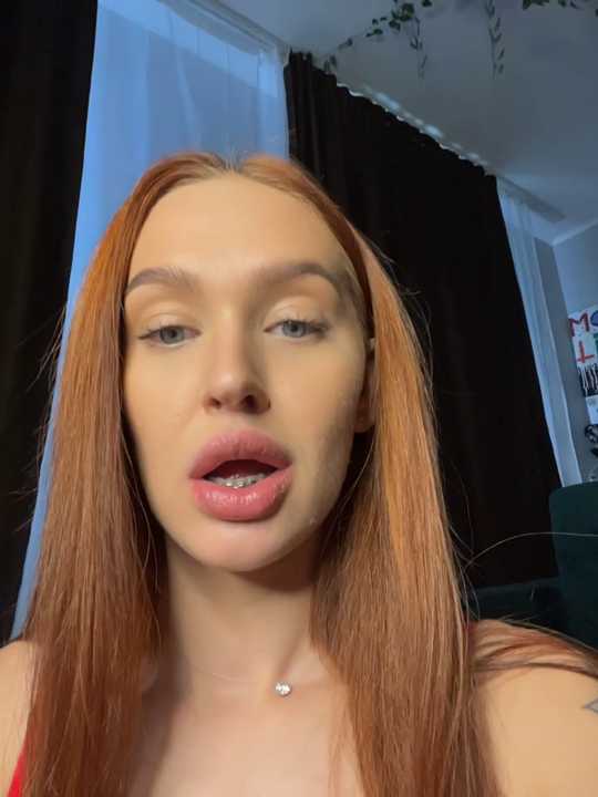LittleFox___