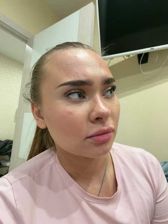 Model