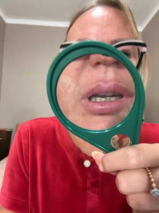michele_nolimi